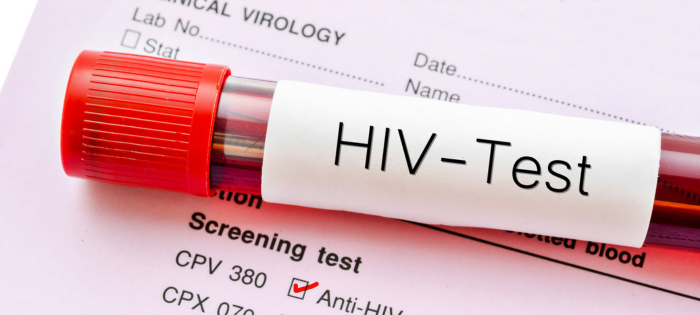 Testing for HIV/HCV